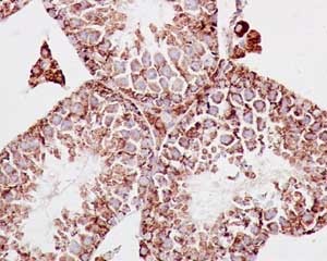 Immunohistochemistry (Formalin/PFA-fixed paraffin-embedded sections) - Anti-MDH2 antibody [EPR14882(B)] (AB181873), expandable thumbnail