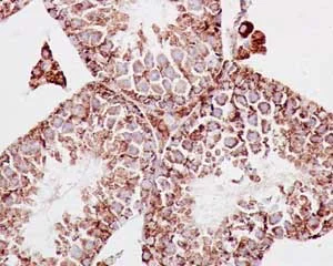 Immunohistochemistry (Formalin/PFA-fixed paraffin-embedded sections) - Anti-MDH2 antibody [EPR14882(B)] - BSA and Azide free (AB250541)
