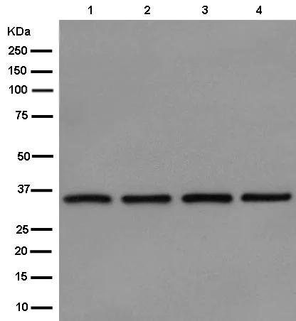 Western blot - Anti-MDH2 antibody [EPR14882(B)] - BSA and Azide free (AB250541)