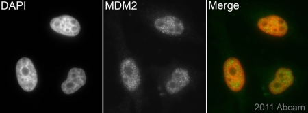 Immunocytochemistry - Anti-MDM2 antibody [2A10] (AB16895), expandable thumbnail