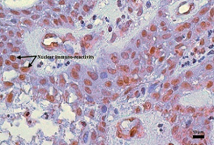 Immunohistochemistry (Formalin/PFA-fixed paraffin-embedded sections) - Anti-MDM2 antibody [2A10] (AB16895), expandable thumbnail