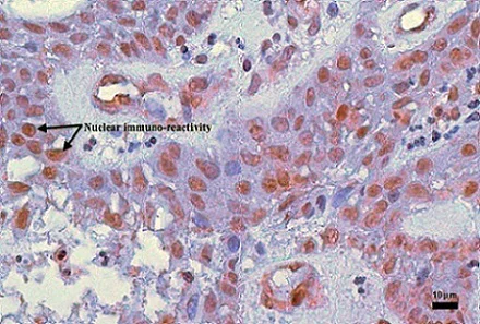 Immunohistochemistry (Formalin/PFA-fixed paraffin-embedded sections) - Anti-MDM2 antibody [2A10] (AB16895)