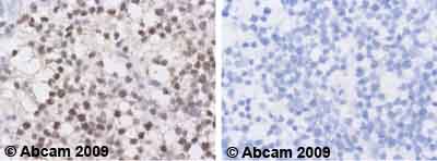 Immunohistochemistry (Formalin/PFA-fixed paraffin-embedded sections) - Anti-MDM2 antibody [2A10] (ab16895), expandable thumbnail