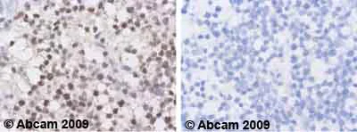 Immunohistochemistry (Formalin/PFA-fixed paraffin-embedded sections) - Anti-MDM2 antibody [2A10] (AB16895)