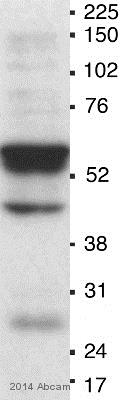 Western blot - Anti-MDM2 antibody [2A10] (AB16895), expandable thumbnail