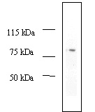 Western blot - Anti-MDM2 antibody [2A10] (AB16895), expandable thumbnail
