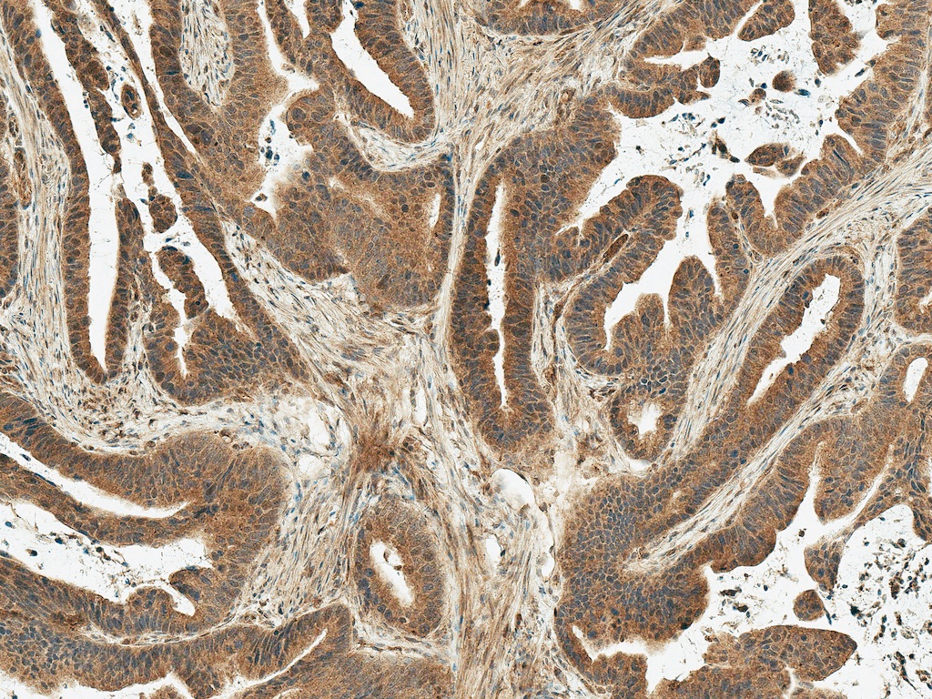 Immunohistochemistry (Formalin/PFA-fixed paraffin-embedded sections) - Anti-MDM2 antibody (AB260074), expandable thumbnail