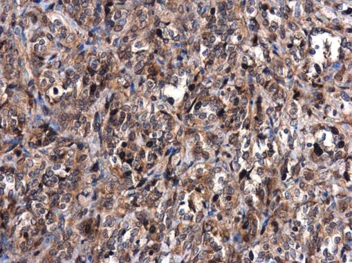 Immunohistochemistry (Formalin/PFA-fixed paraffin-embedded sections) - Anti-MDM2 antibody - ChIP Grade (ab226939), expandable thumbnail