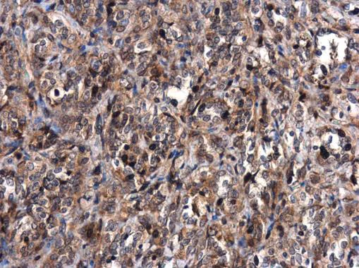 Immunohistochemistry (Formalin/PFA-fixed paraffin-embedded sections) - Anti-MDM2 antibody - ChIP Grade (AB226939)