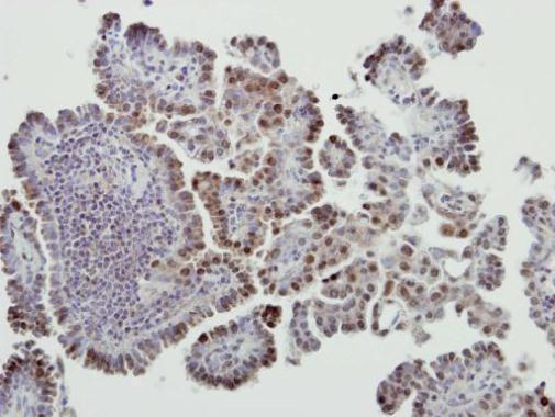 Immunohistochemistry (Formalin/PFA-fixed paraffin-embedded sections) - Anti-MDM2 antibody - ChIP Grade (ab226939), expandable thumbnail