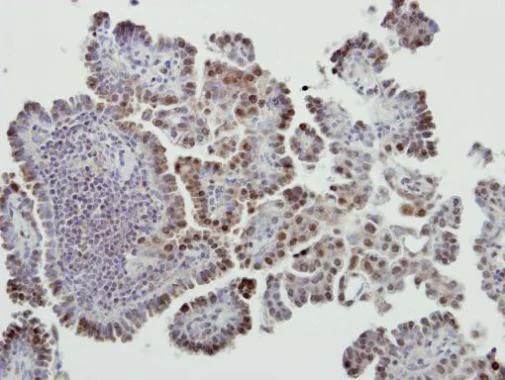 Immunohistochemistry (Formalin/PFA-fixed paraffin-embedded sections) - Anti-MDM2 antibody - ChIP Grade (AB226939)