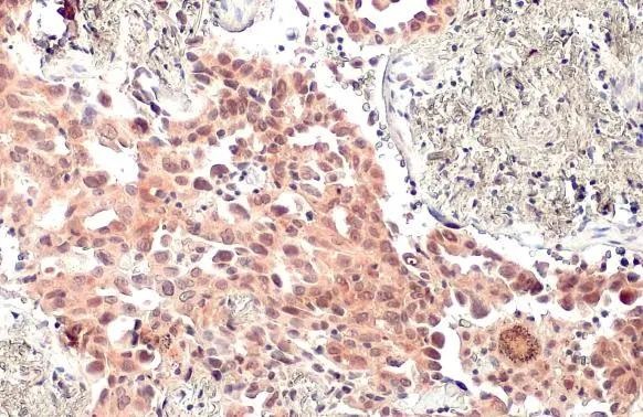 Immunohistochemistry (Formalin/PFA-fixed paraffin-embedded sections) - Anti-MDM2 antibody - ChIP Grade (AB226939)