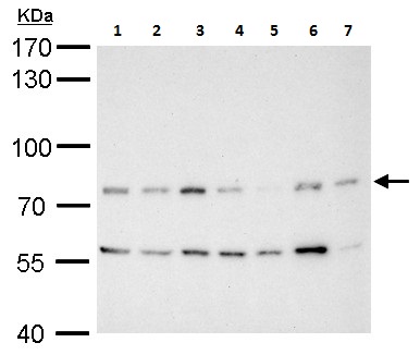 Western blot - Anti-MDM2 antibody - ChIP Grade (AB226939), expandable thumbnail