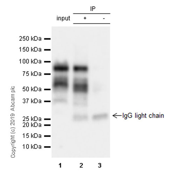 Immunoprecipitation - Anti-MDM2 antibody [EPR22256-98] - BSA and Azide free (AB259275), expandable thumbnail