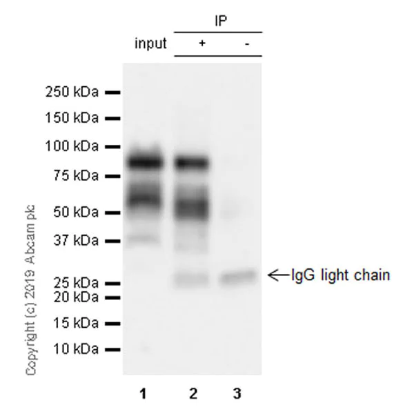 Immunoprecipitation - Anti-MDM2 antibody [EPR22256-98] - BSA and Azide free (AB259275)
