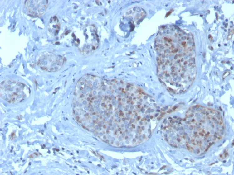 Immunohistochemistry (Formalin/PFA-fixed paraffin-embedded sections) - Anti-MDM2 antibody [SMP14] (AB263453)