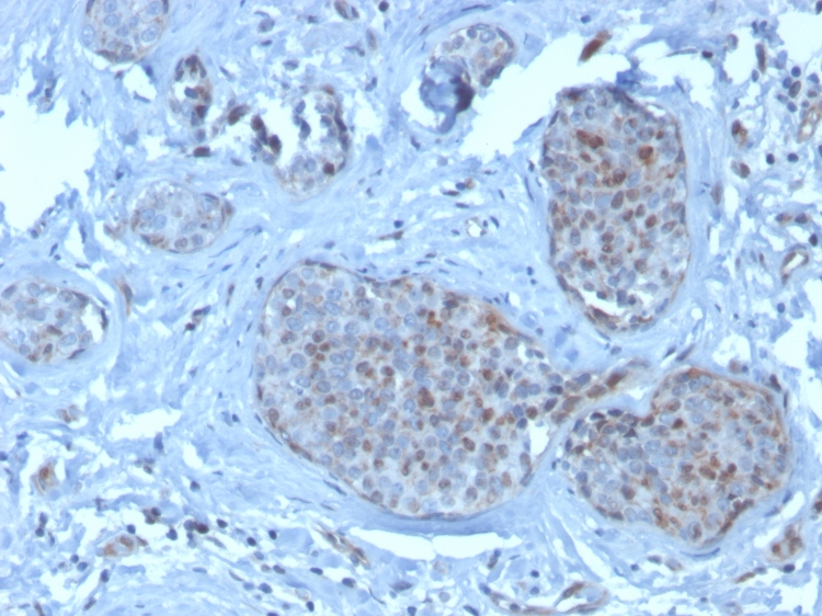 Immunohistochemistry (Formalin/PFA-fixed paraffin-embedded sections) - Anti-MDM2 antibody [SMP14] - BSA and Azide free (AB263457)