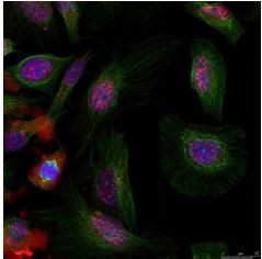 Immunocytochemistry/ Immunofluorescence - Anti-MDM2 (phospho S166) antibody (AB131355), expandable thumbnail