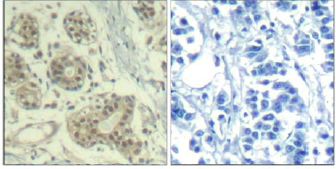 Immunohistochemistry (Formalin/PFA-fixed paraffin-embedded sections) - Anti-MDM2 (phospho S166) antibody (AB131355), expandable thumbnail