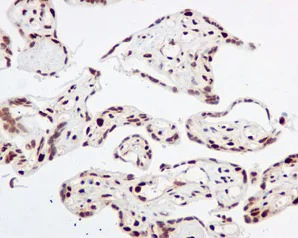 Immunohistochemistry (Formalin/PFA-fixed paraffin-embedded sections) - Anti-MDM2 (phospho S166) antibody [EPR1450(2)] (AB170880)