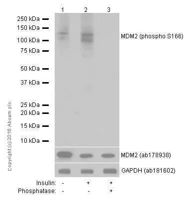 Western blot - Anti-MDM2 (phospho S166) antibody [EPR1450(2)] (AB170880)