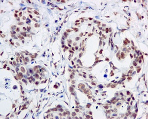 Immunohistochemistry (Formalin/PFA-fixed paraffin-embedded sections) - Anti-MDM2 (phospho S166) antibody [EPR1450(2)] - BSA and Azide free (AB249560), expandable thumbnail