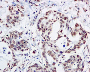 Immunohistochemistry (Formalin/PFA-fixed paraffin-embedded sections) - Anti-MDM2 (phospho S166) antibody [EPR1450(2)] - BSA and Azide free (AB249560)
