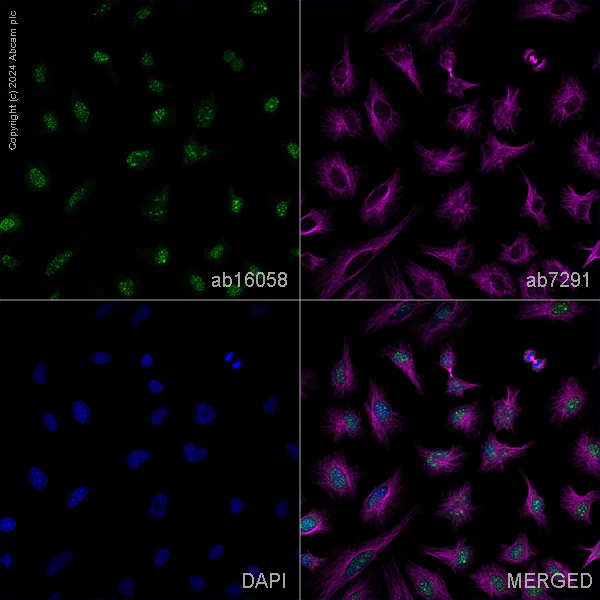 Immunocytochemistry/ Immunofluorescence - Anti-MDMX/MDM4 antibody (AB16058)
