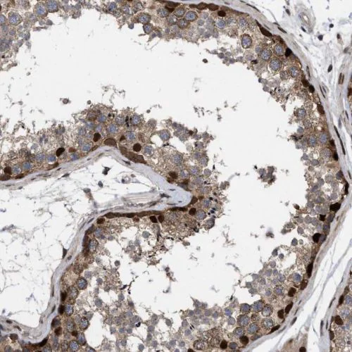 Immunohistochemistry (Formalin/PFA-fixed paraffin-embedded sections) - Anti-MDMX/MDM4 antibody (AB244366)