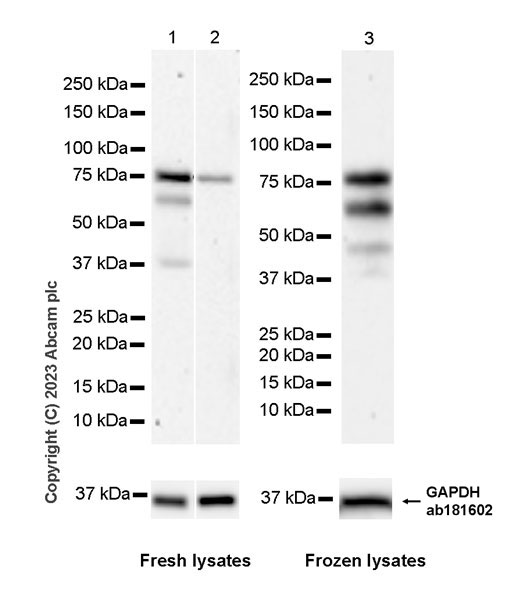 Western blot - Anti-MDMX/MDM4 antibody [EPR25209-54] (AB313614)