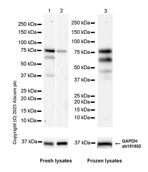 Western blot - Anti-MDMX/MDM4 antibody [EPR25209-54] - BSA and Azide free (AB313615)