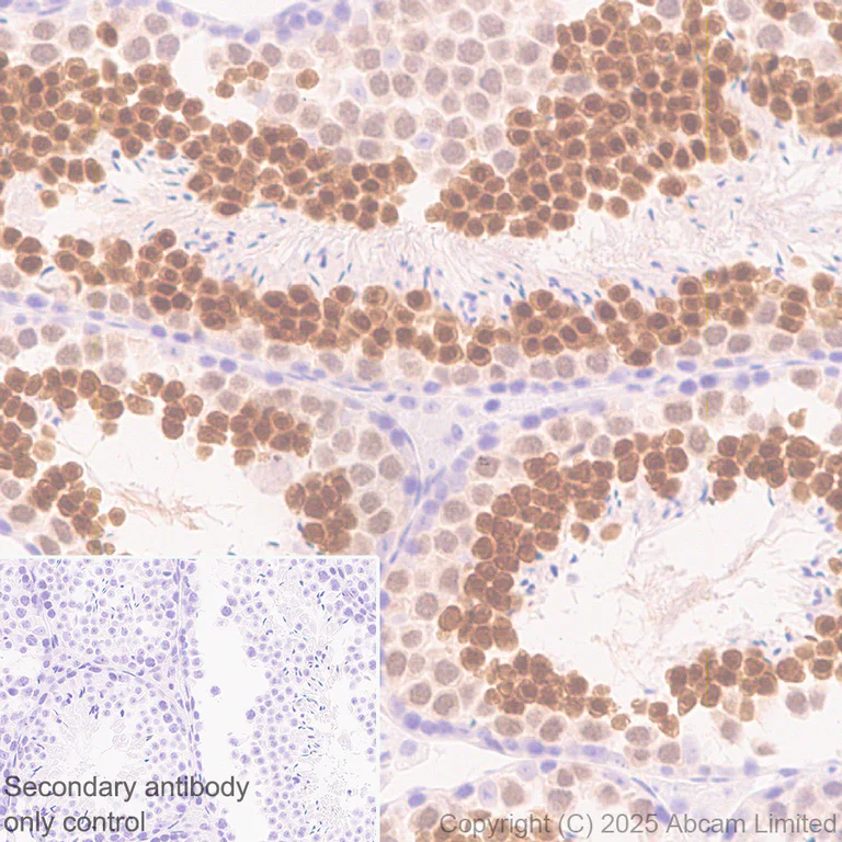 Immunohistochemistry (Formalin/PFA-fixed paraffin-embedded sections) - Anti-MDMX/MDM4 antibody [EPR30428-545] (AB325337)