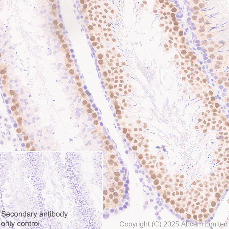 Immunohistochemistry (Formalin/PFA-fixed paraffin-embedded sections) - Anti-MDMX/MDM4 antibody [EPR30428-545] (AB325337)