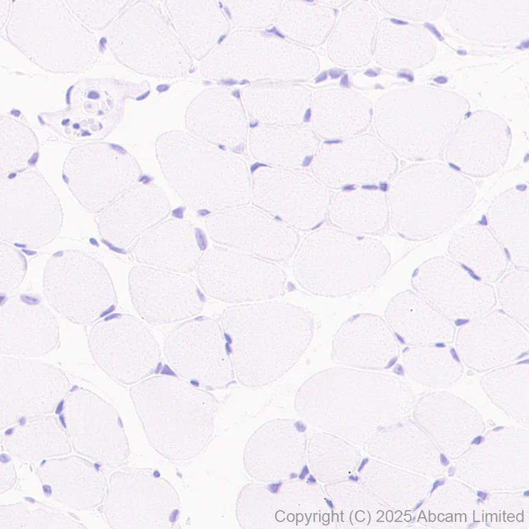 Immunohistochemistry (Formalin/PFA-fixed paraffin-embedded sections) - Anti-MDMX/MDM4 antibody [EPR30428-545] (AB325337)
