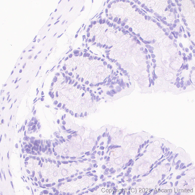 Immunohistochemistry (Formalin/PFA-fixed paraffin-embedded sections) - Anti-MDMX/MDM4 antibody [EPR30428-545] (AB325337)