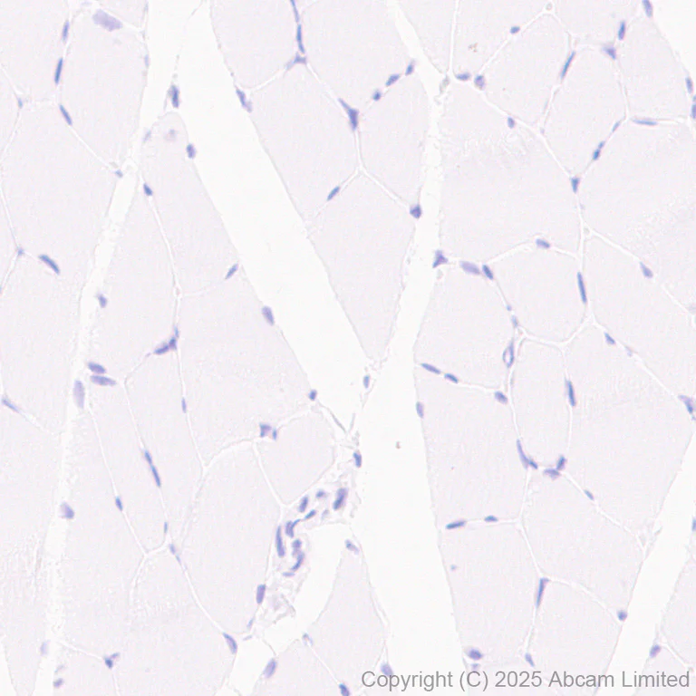 Immunohistochemistry (Formalin/PFA-fixed paraffin-embedded sections) - Anti-MDMX/MDM4 antibody [EPR30428-545] (AB325337)