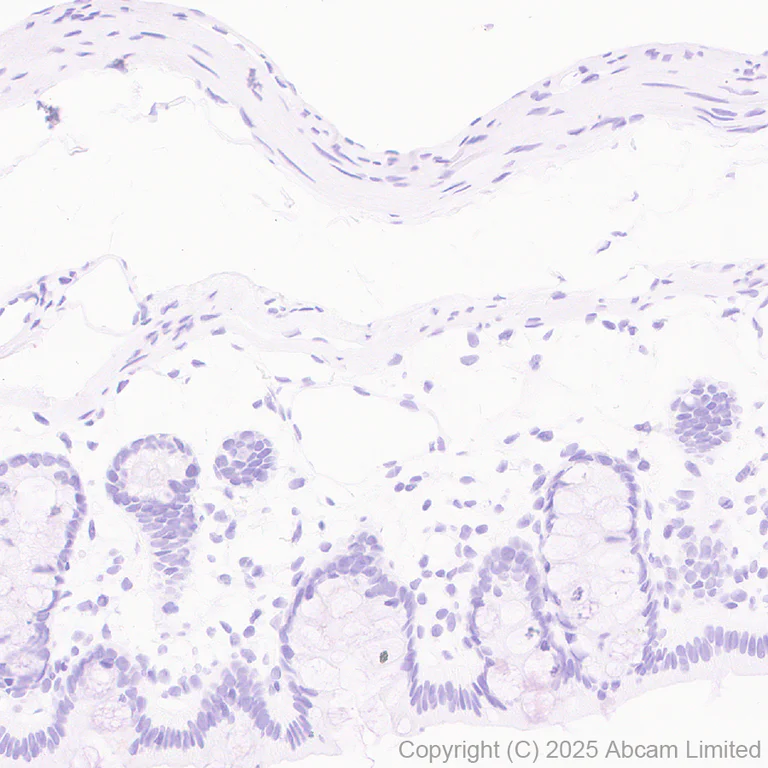 Immunohistochemistry (Formalin/PFA-fixed paraffin-embedded sections) - Anti-MDMX/MDM4 antibody [EPR30428-545] (AB325337)