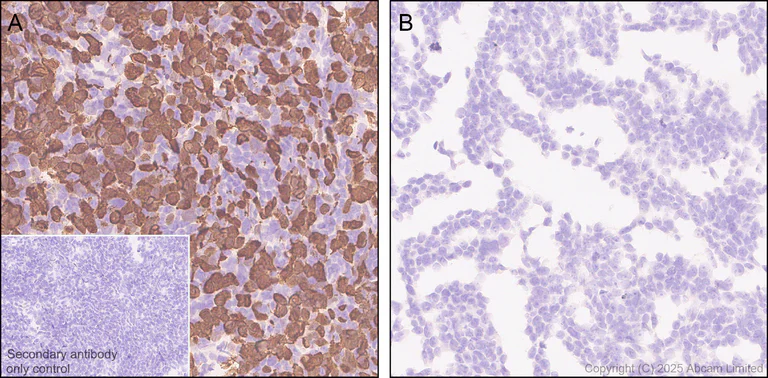 Immunohistochemistry (Formalin/PFA-fixed paraffin-embedded sections) - Anti-MDMX/MDM4 antibody [EPR30428-545] (AB325337)