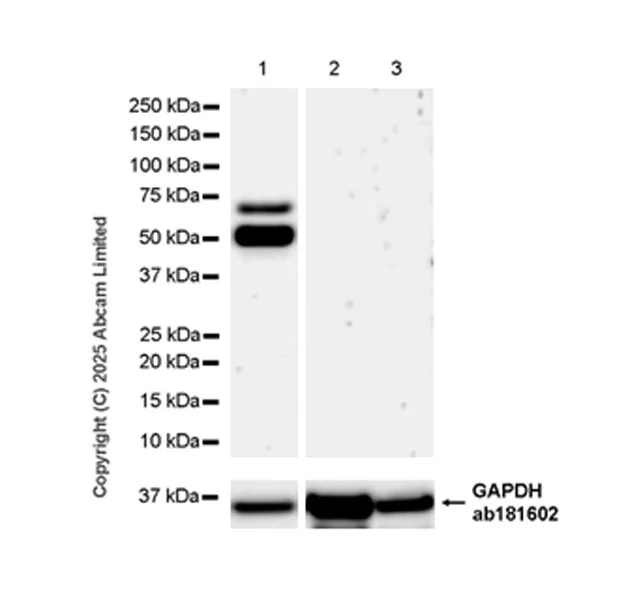 Western blot - Anti-MDMX/MDM4 antibody [EPR30428-545] (AB325337)