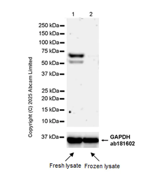 Western blot - Anti-MDMX/MDM4 antibody [EPR30428-545] (AB325337)