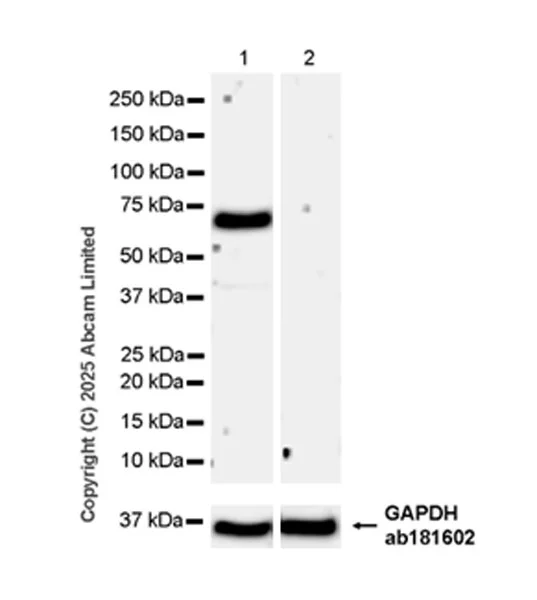 Western blot - Anti-MDMX/MDM4 antibody [EPR30428-545] (AB325337)