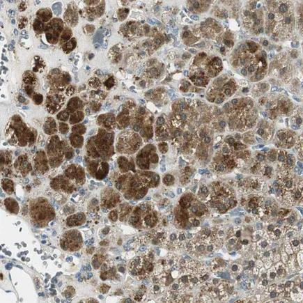 Immunohistochemistry (Formalin/PFA-fixed paraffin-embedded sections) - Anti-ME1 antibody (AB223761)