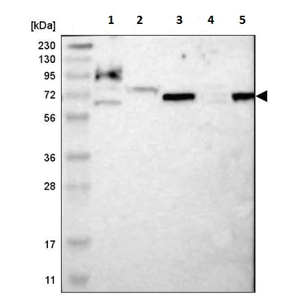Western blot - Anti-ME1 antibody (AB223761)
