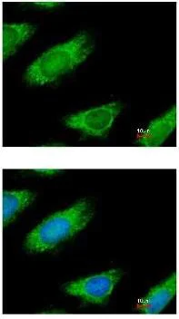 Immunocytochemistry/ Immunofluorescence - Anti-ME1 antibody (AB97445)
