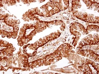 Immunohistochemistry (Formalin/PFA-fixed paraffin-embedded sections) - Anti-ME1 antibody (AB97445)
