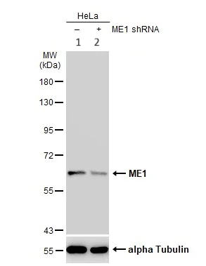 Western blot - Anti-ME1 antibody (AB97445)