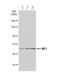 Western blot - Anti-ME1 antibody (AB97445)