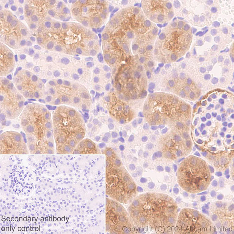 Immunohistochemistry (Formalin/PFA-fixed paraffin-embedded sections) - Anti-ME1 antibody [EPR28891-30] - BSA and Azide free (AB324831)