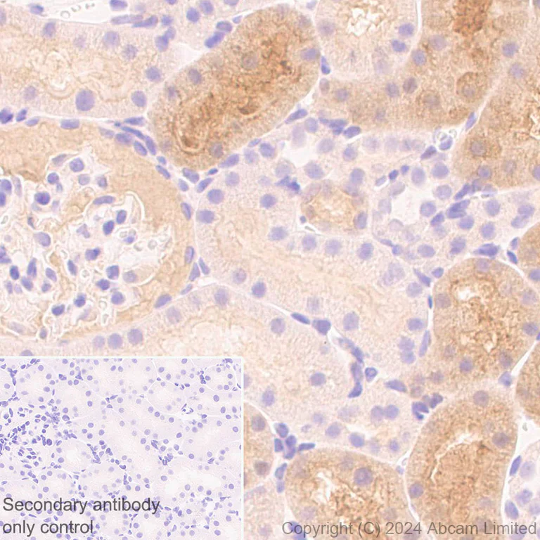 Immunohistochemistry (Formalin/PFA-fixed paraffin-embedded sections) - Anti-ME1 antibody [EPR28891-30] - BSA and Azide free (AB324831)