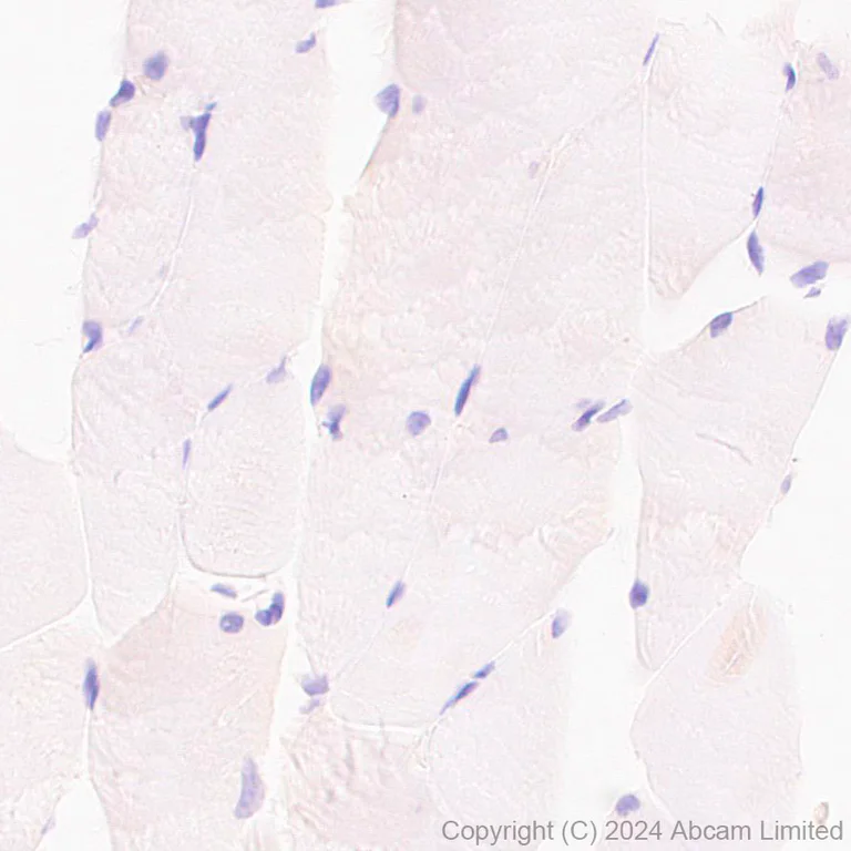 Immunohistochemistry (Formalin/PFA-fixed paraffin-embedded sections) - Anti-ME1 antibody [EPR28891-30] - BSA and Azide free (AB324831)